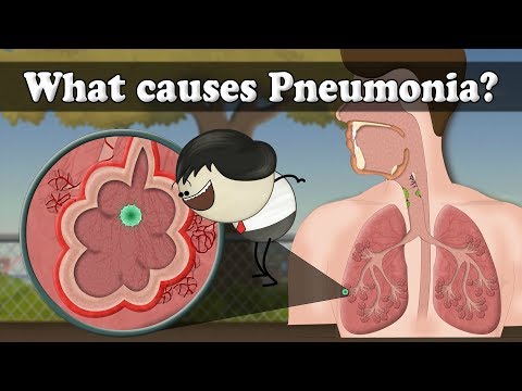 What causes Pneumonia?