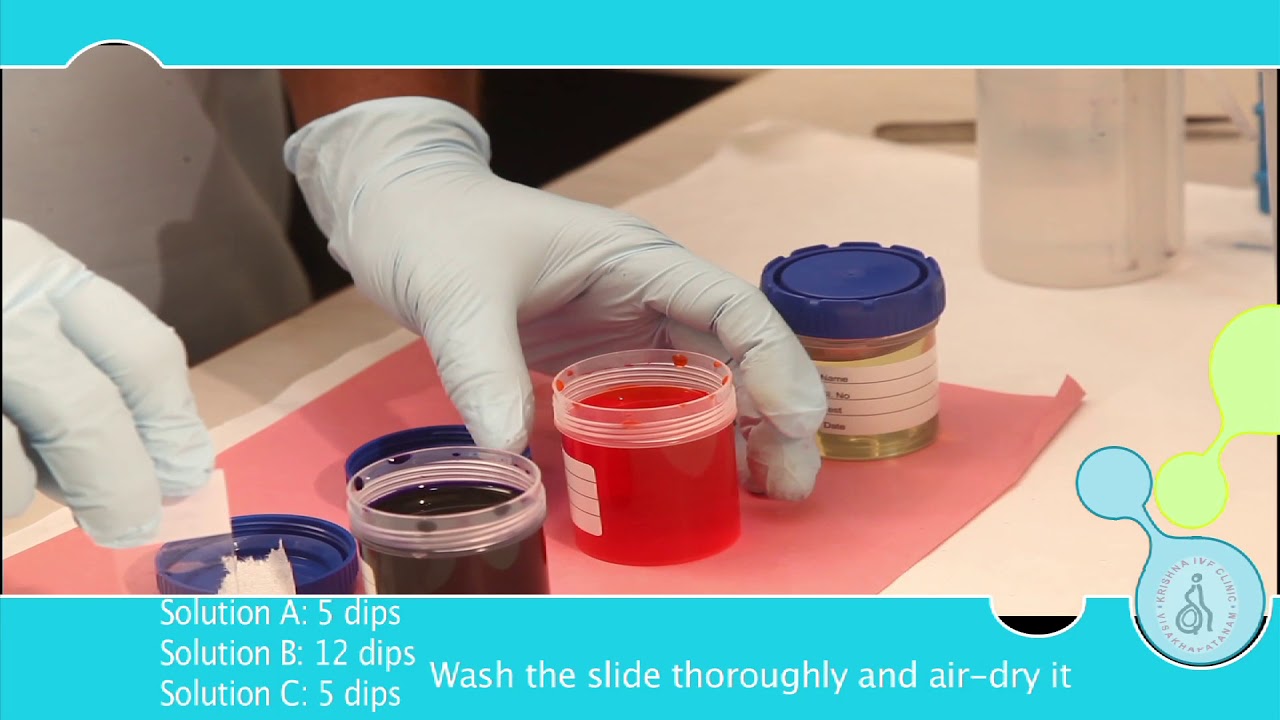 Semen analysis with CASA