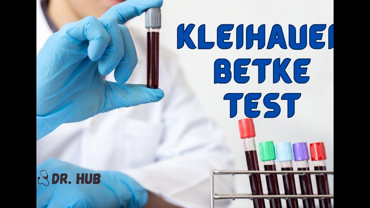 Kleihauer Betke test YouTube