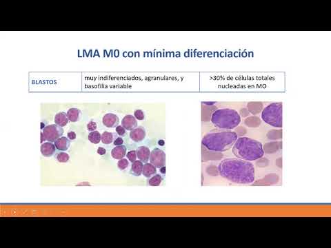 Vídeo: Aparición De Heterogeneidad En Leucemias Agudas