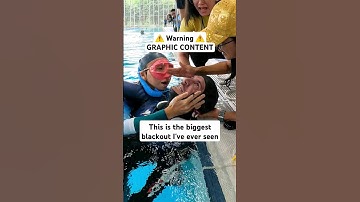 ⚠️ GRAPHIC ⚠️ FREEDIVING ACCIDENT! 😵💦 #freediving #freediver #extremesports #shorts