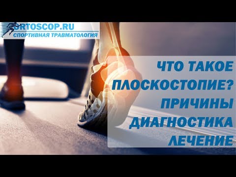 ЧТО ТАКОЕ ПЛОСКОСТОПИЕ? ПРИЧИНЫ. ДИАГНОСТИКА. ЛЕЧЕНИЕ