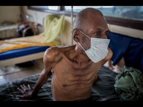Video: Kas Ebola Viirus Saab Muteeruda Ja Levida õhu Kaudu? - Alternatiivne Vaade