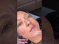 En pré un très beau travail au niveau des lèvres 411 rue notre dame à Repentigny #botox#injection
