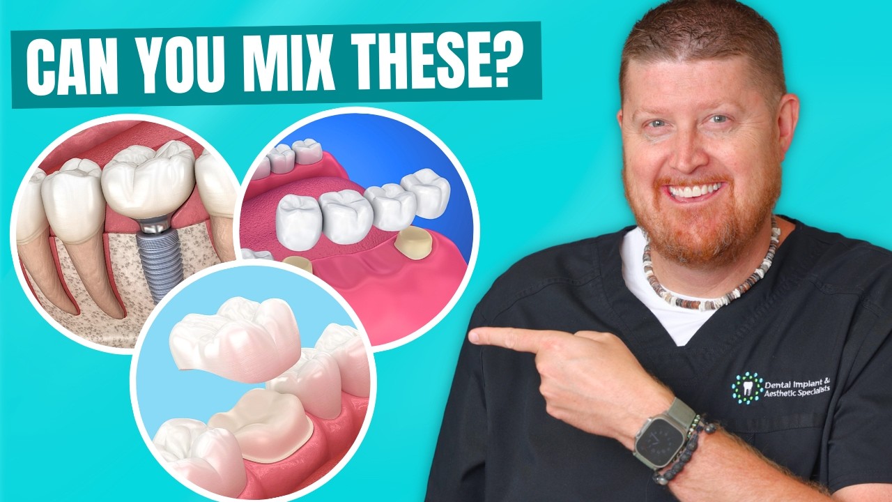 Можно ли сочетать коронки, мосты и имплантаты?