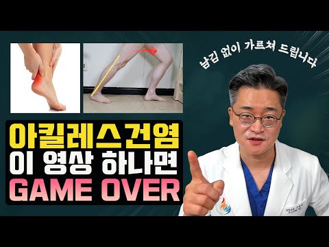 아킬레스건염 이 영상 하나로 종결(원인, 치료, 스트레칭 방법 등)