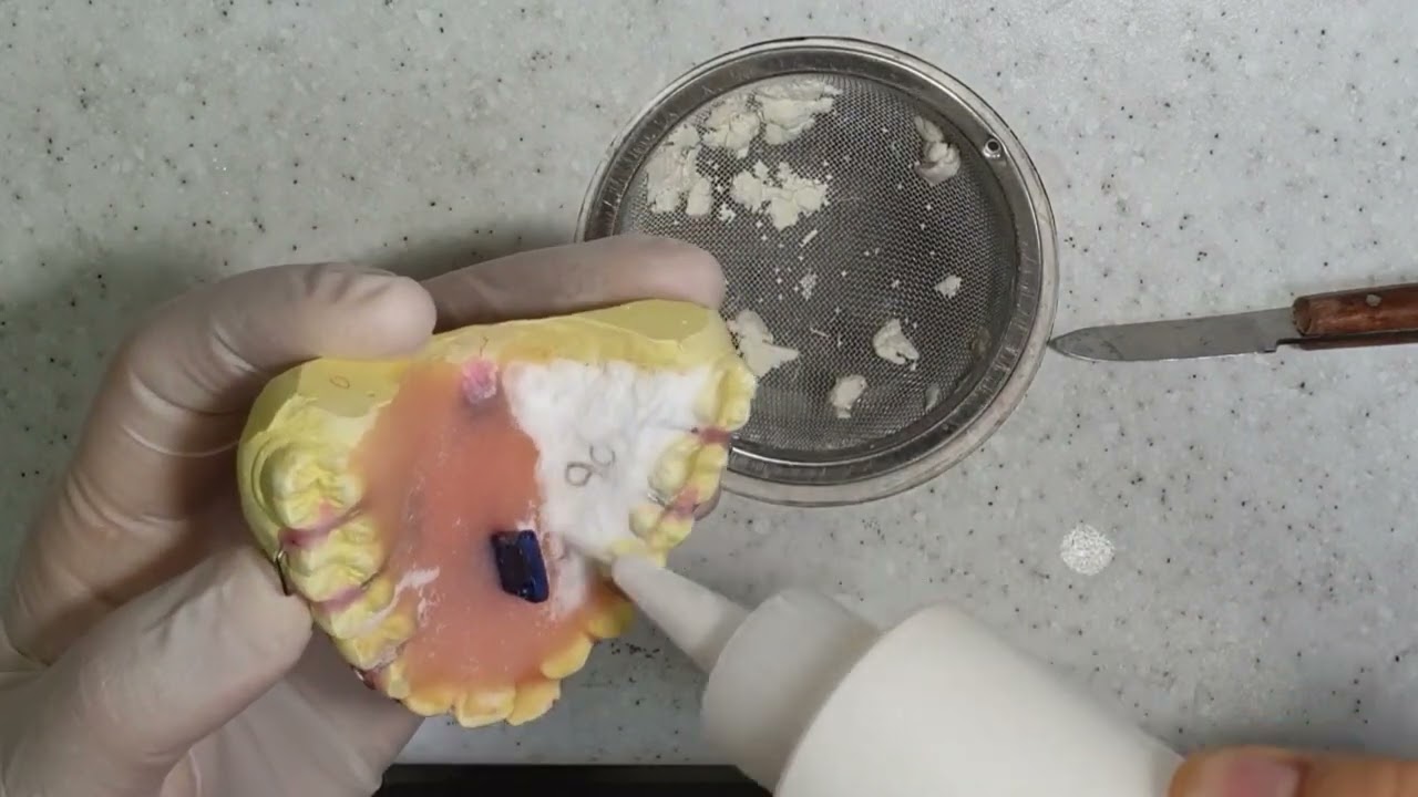 Fan type Expander resin pouring/Fan type expansion plate