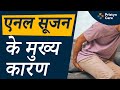 Anal Swelling: मुख्य कारण जानें