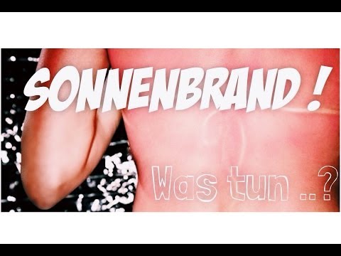 SONNENBRAND -  Was tun ?  ♡ CALL OF BEAUTY ♡