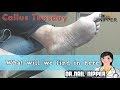 What will we find in here ???  - Callus Tuesday #34