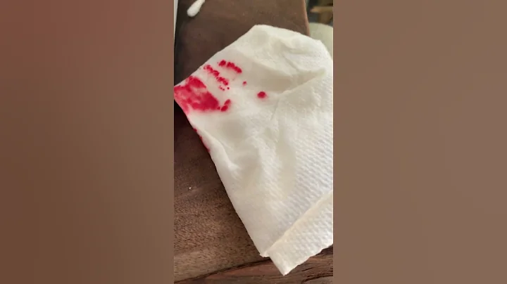 Saving a hurt baby bunny🥺 #cute #sad #heartwarming #bunny #baby - DayDayNews
