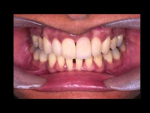 Life changing dentistry