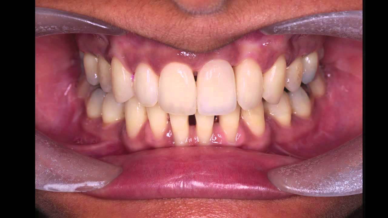 Life changing dentistry - YouTube