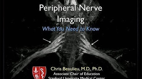Peripheral Nerve Imaging: What You Need to Know