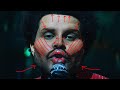 Removing THE WEEKND'S Plastic Surgery