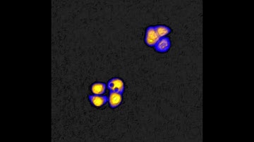 Mesmerizing dance of JIMT-1 breast cancer cells | HoloMonitor®