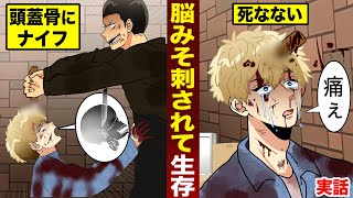 【実話】脳みそ刺されて生存。頭蓋骨にナイフ...死なない。「痛ぇ」