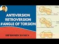 Anterversion& Retroversion( Angle of torsion-hip biomechanics)