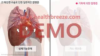 [시연용] c0322aako_[대한비뇨의학회] 복강경 근치적 전립선적출술 안내 [동의서용]