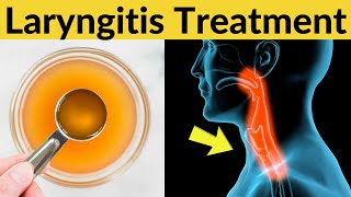 Natural way to get rid of laryngitis, hoarseness throat fast and overnight