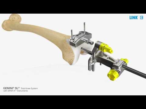 GEMINI SL Total Knee System with SPAR-K Instruments - Surgical technique - USA