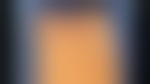 Retroperitoneal SP Robotic partial nephrectomy