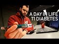 A Day in the Life of a Type 1 Diabetic 💉