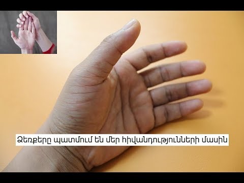 Video: Ինչպես անել մատների հրում