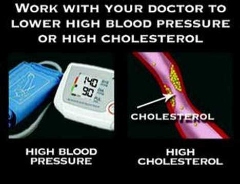 Preventing Stroke (Stroke #4)