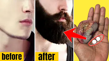 Est-ce que l'huile à barbe fait pousser la barbe ?