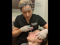 Boost Winter Skincare with Skinvive!