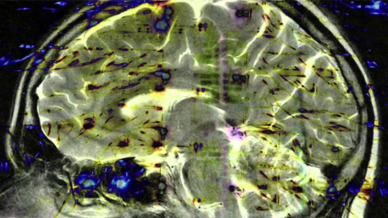 Brain Waves - YouTube
