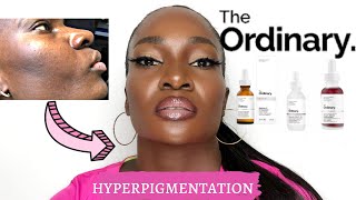 the ordinary products for hyperpigmentation