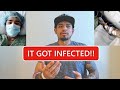 LET&#39;S TALK ABOUT WOUND CARE!!  (I GOT AN INFECTION!!)