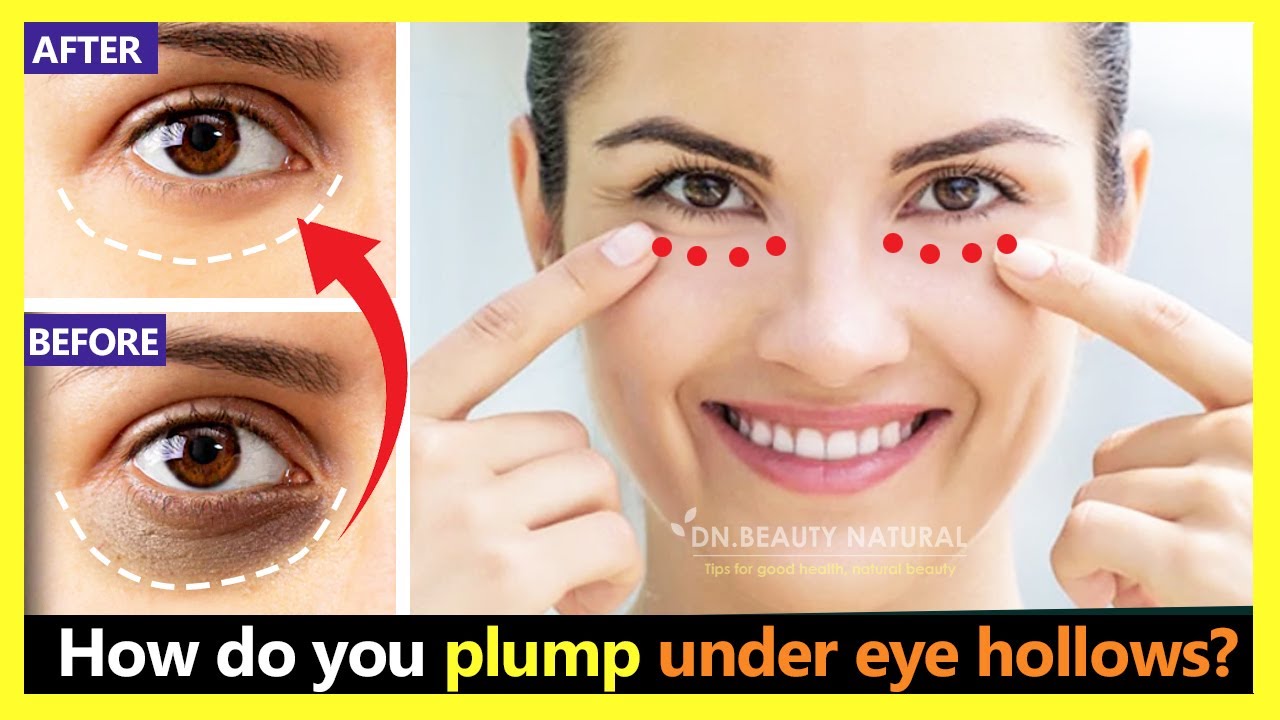 How To Get Rid Of Sunken Eyes Eye Hollow