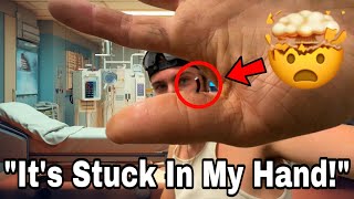 WARNING: Biggest Magnet Fishing Freak Accident EVER Requires Hospital Emergency Room!