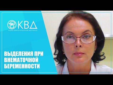 Видео: Постоянна ли боль при внематочной беременности?