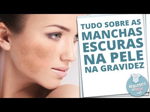 Vídeo: Manchas Na Gravidez: O Que é Normal E Quando Procurar Ajuda