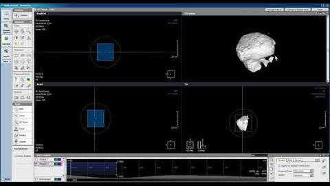 Xelis Dental Case Tutorial Segment Sinus