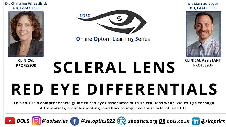 #ScleralLens Red Eye Differentials #BestLenses | O...