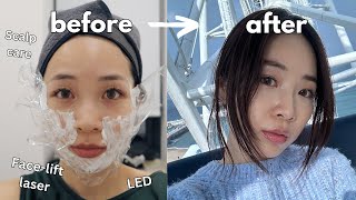 $1500 Extreme Glow Up Transformation in Korea | Face-lifting Laser, Scalp Care, Olive Young Haul