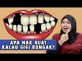 Apa Nak Buat Kalau Gigi Rongak?