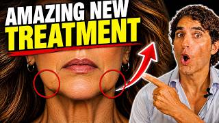Amazing *NEW * NO SURGERY TREATMENT FOR JOWLS