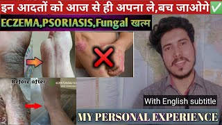 सोराइसिस: How to cure Psoriasis, eczema and fungal infection, My personal experience.