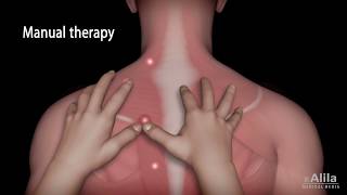 Trigger Point Therapy - Explained