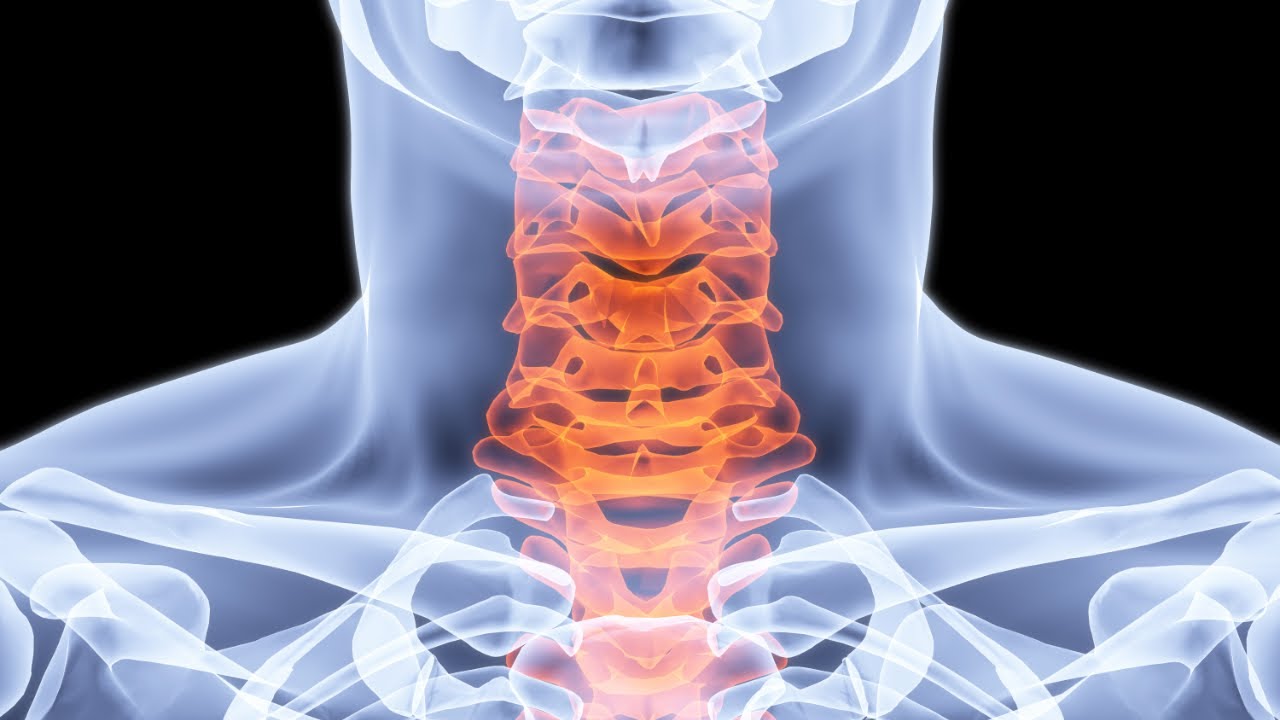 What is cervicalgia can chiropractic help wyoming forest lake mn