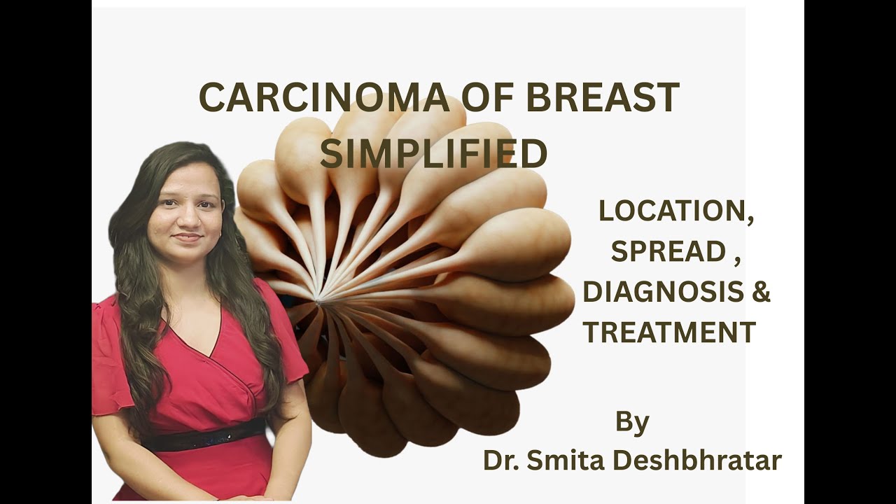 CARCINOMA OF BREAST SIMPLIFIED - PART 4 (CLINICAL ANATOMY OF BREAST)