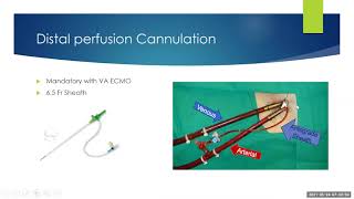 ECMO Introduction for ED: Types of ECMO Modalities / Cannulation strategies screenshot 4