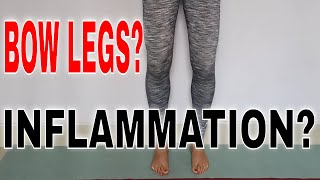Bow Legs Yoga For Inflammation And Osteoarthritis