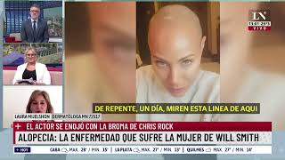 Alopecia: la enfermedad que sufre la mujer de Will Smith